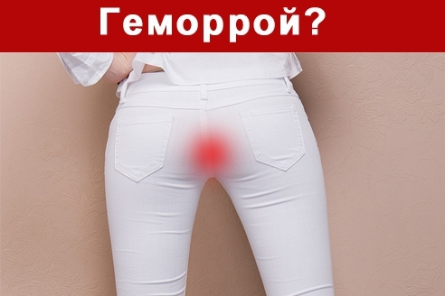 Геморрой? Чтоб вылечить его, не нужно ходить к врачу. Надо...